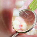 Clinica de medicina dentara Dr TEO Zambim impreuna PEDODONTIA