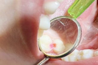 Clinica de medicina dentara Dr TEO Zambim impreuna PEDODONTIA