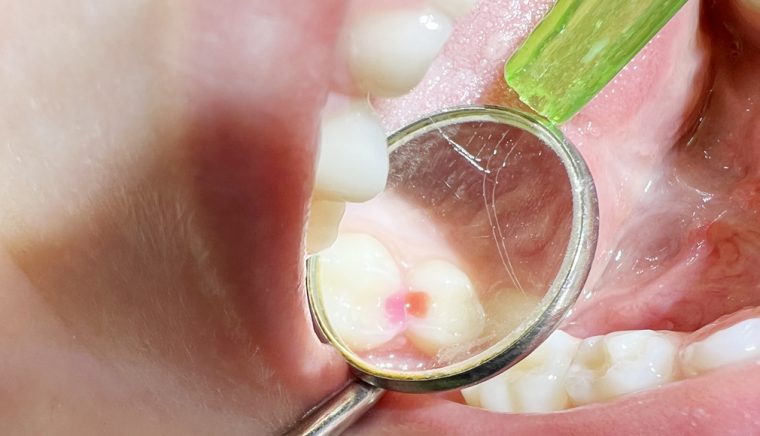 Clinica de medicina dentara Dr TEO Zambim impreuna PEDODONTIA