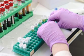 Alerte medicala primul caz uman cu parazitul distrugator de tesuturi