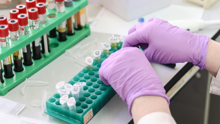 Alerte medicala primul caz uman cu parazitul distrugator de tesuturi