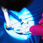 Clinica de medicina dentara Dr TEO Zambim impreuna Coroanele dentare