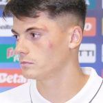 Mario Tudose dupa accidentare Sunt ok