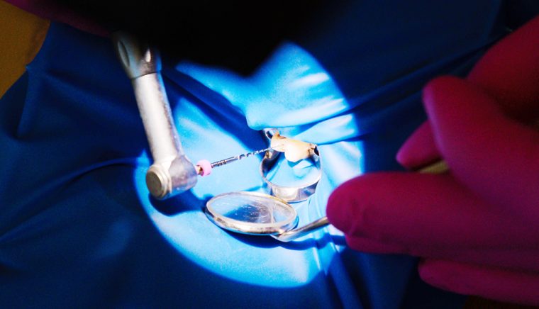 Clinica de medicina dentara Dr TEO Zambim impreuna Coroanele dentare