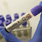 sapte cazuri de hepatita a confirmate dintr un judet