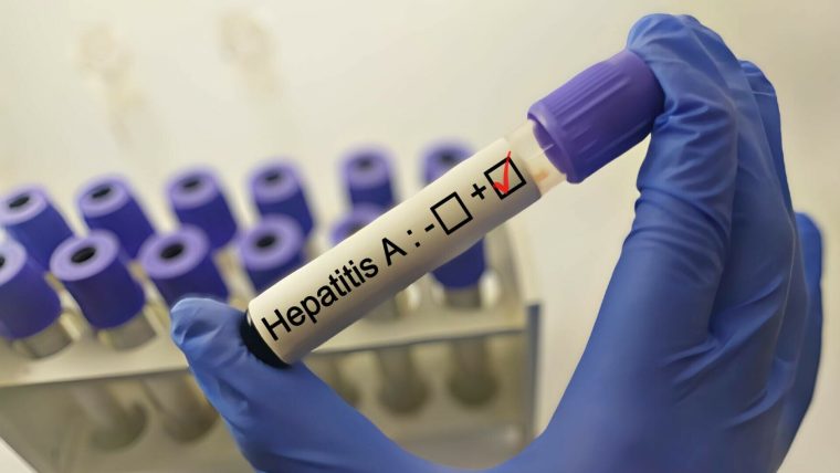 sapte cazuri de hepatita a confirmate dintr un judet