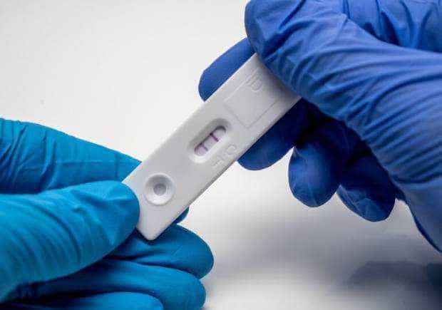 Avertisment in UE teste COVID 19 si gripa false