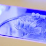 Clinica Dr TEO Zambim impreuna Protese dentare cu capse