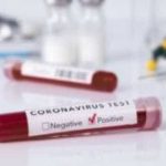 Fost deputat croat si fiul sau acuzati de vanzarea de teste COVID 19 contrafacute