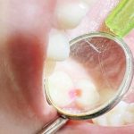 Clinica de medicina dentara Dr TEO Zambim impreuna oricand PEDODONTIE