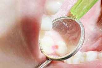 Clinica de medicina dentara Dr TEO Zambim impreuna oricand PEDODONTIE