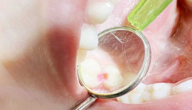 Clinica de medicina dentara Dr TEO Zambim impreuna oricand PEDODONTIE