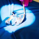 Clinica de stomatologie Dr TEO Zambim impreuna oricand Eroziunea dentara