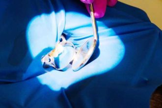 Clinica de stomatologie Dr TEO Zambim impreuna oricand Eroziunea dentara