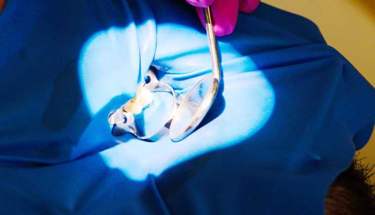 Clinica de stomatologie Dr TEO Zambim impreuna oricand Eroziunea dentara