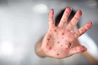Criza vaccinarii scapa de sub control Romania conduce statisticile rujeolei in Europa