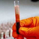 Particule de plastic in sange efecte asupra celulelor sanguine