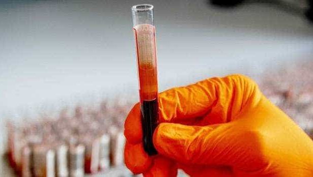 Particule de plastic in sange efecte asupra celulelor sanguine