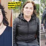 Femeia mutilata de un sofer vitezoman primeste despagubiri uriaase din partea instantei dar asiguratorul este in faliment